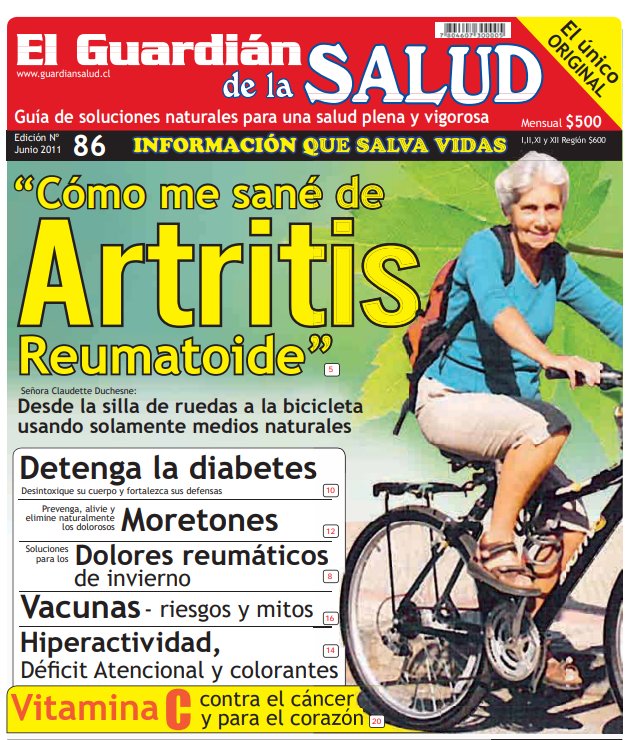 Edición artritis